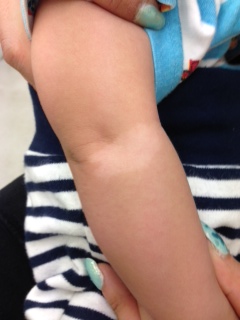 尋常性白斑の治し方美容皮膚科 銀座よしえクリニック 公式 東京