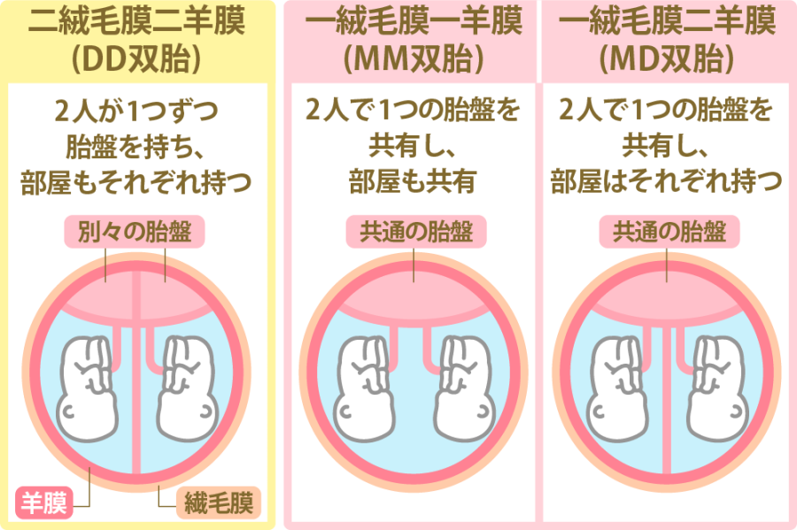 双子や三つ子が生まれる確率は？通常の育児との違いについても解説！ヘルメット治療ならスターバンドのAHS Japan