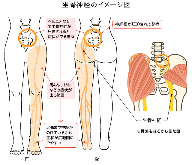 ゴルフ後に股関節が痛い？ストレッチで防ぐ方法とは - 札幌ひざのセルクリニック変形性膝関節症・手術しない膝治療