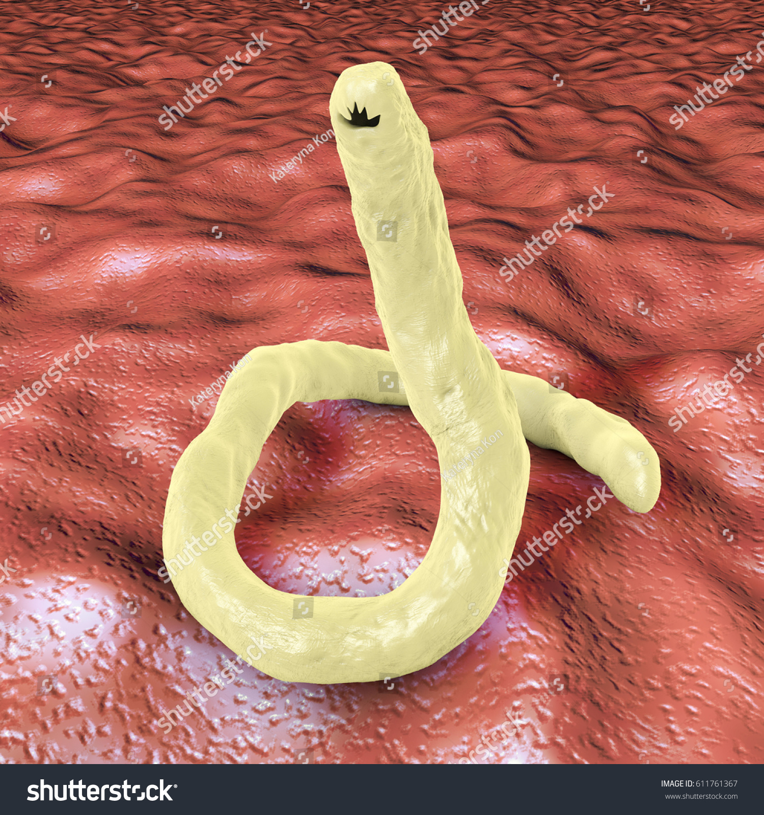 十二指腸虫, じゅうにしちょうちゅう, jūnishichōchū - Nihongo Master