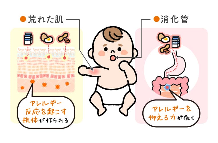 食物アレルギーときえだ小児科クリニック 公式
