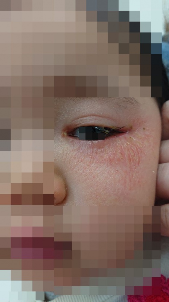 涙道 - 仙台なみだの眼科クリニック涙道疾患 なみだ目・目やに の専門医です