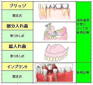 カチッと入れ歯」の取り外しの2例津谷良