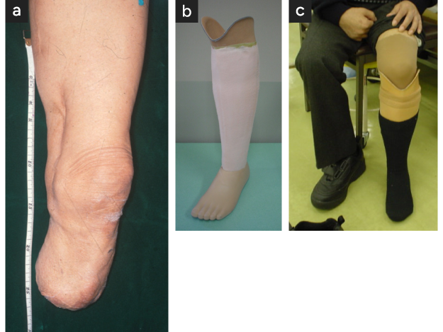 足を大切断から救う血管外科医 笹嶋唯博