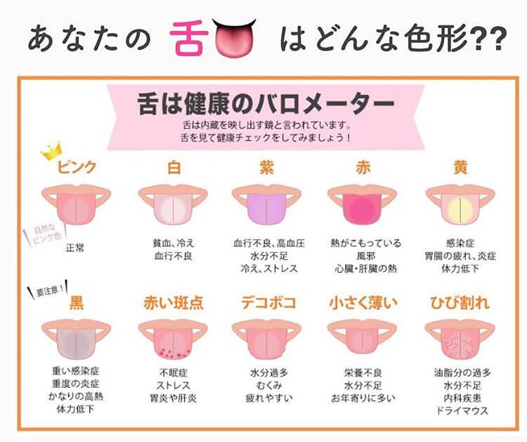 舌痛症は何科で受診すべきか？ラクシア銀座歯科クリニック