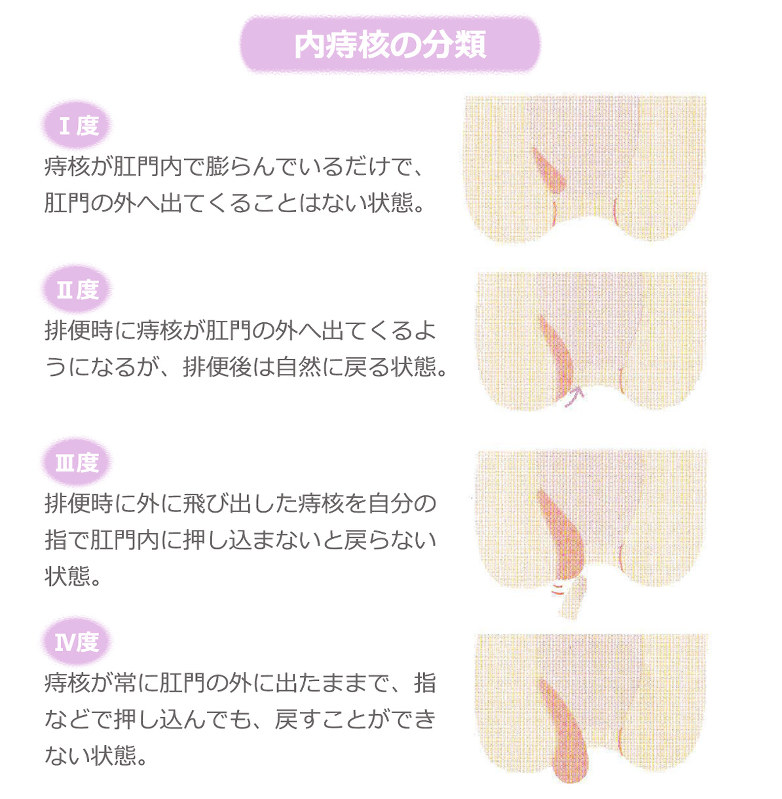 千葉の松戸市で女性のお尻のお悩みなら加賀谷正クリニック