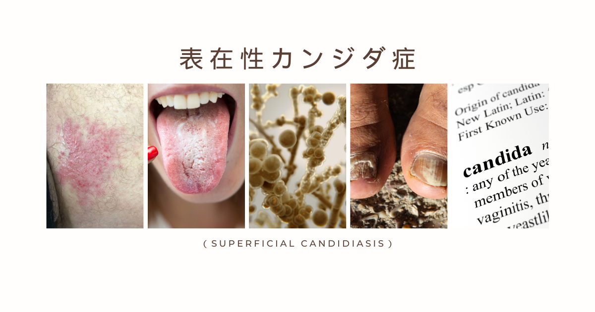 男性は彼の舌、開いた口、暗い影に過成長カンジダ症を示していますの写真素材・画像素材 Image 196719821