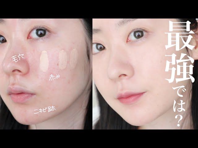 新感覚 ニキビ跡をパッチする！？ファンデーション誕生！株式会社ミシャジャパンのプレスリリース