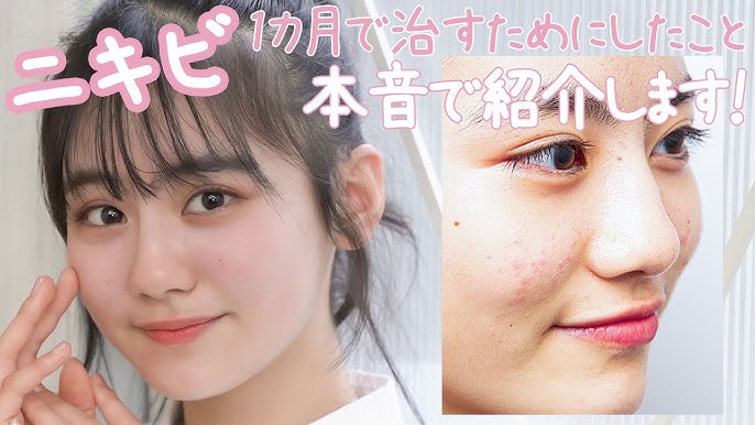 高校生向け ニキビ洗顔料のおすすめ21選！モデルが使ってる人気アイテム＆