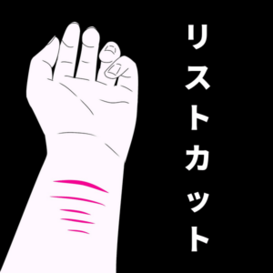 風俗面接】リストカット跡があると面接に落ちやすい？ | 桃源郷クラブJOB