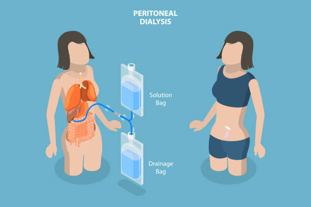 腎・泌尿器」カテゴリのイラスト🎨 2フリー素材 看護roo! カンゴルー