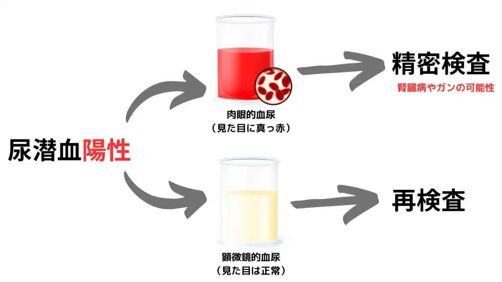 和牛の麻痺性ミオグロビン尿症か？ : 北の 来たの？ 獣医師