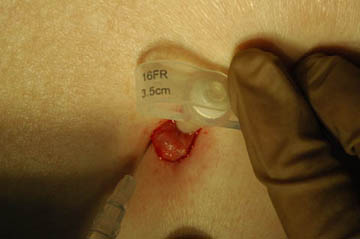 会陰切開 をするタイミングは？痛みはある？切らない人もいる？会陰切開の不安と疑問に産婦人科医がお答えBaby-mo ベビモ