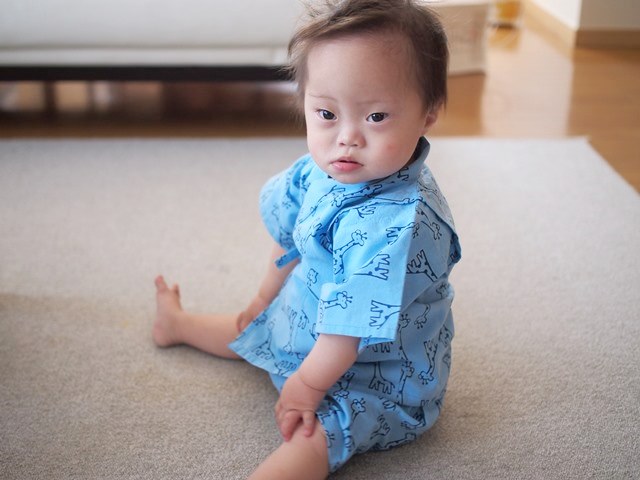 ダウン症新生児の目や耳など顔の特徴は？手や足などの身体的特徴も紹介東京・ミネルバクリニック