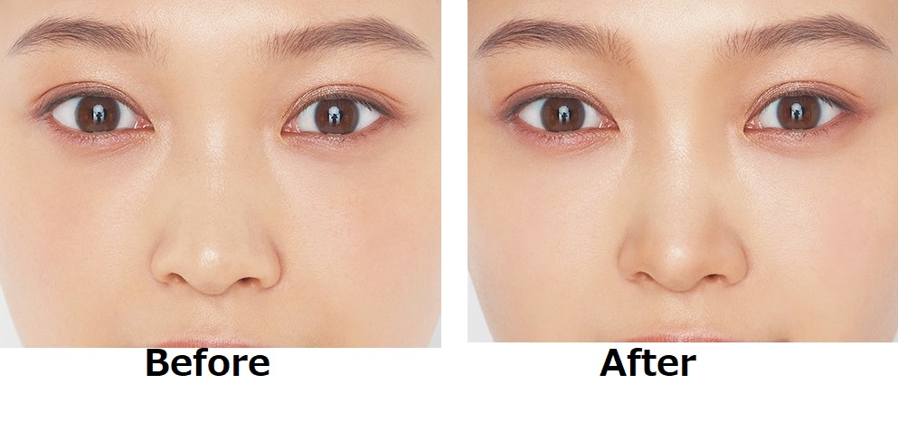 小顔に近づく！余白埋めメイクの方法とコツ