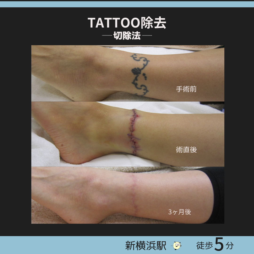 お客様の声 23名古屋の女彫師タトゥースタジオYogi tattoo