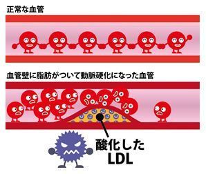 脂質異常症らいふサイエンス内科クリニック