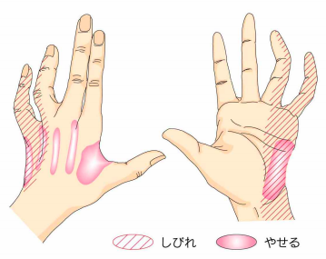 楽天市場 ＊ソフトバリアフリーはし HS-H 長さ20.5cm お箸 つかみやすい トング式 : ひと、モノショップ