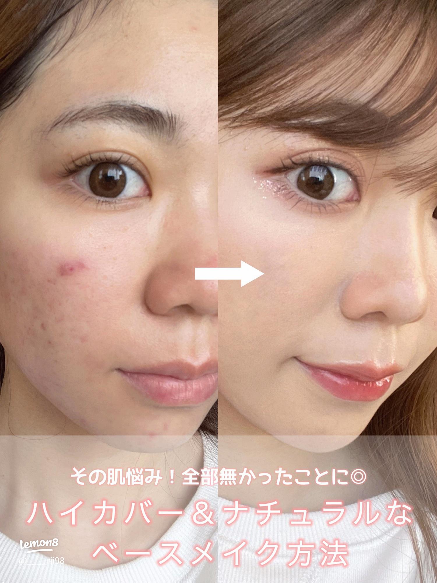 ファンデが絶対に崩れる、、 - 私の肌はニキビが多く、乾燥も Q&A - @cosme アットコスメ