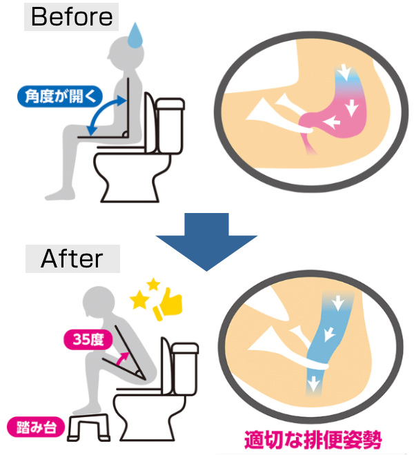 トイレ用踏み台 ステップ台 トイレステップ トイレ踏み台 姿勢 子ども 大人 お年寄り しゃがむ 体勢 洋式 トレーニング 便秘解消 介護用品便利グッズ zk134