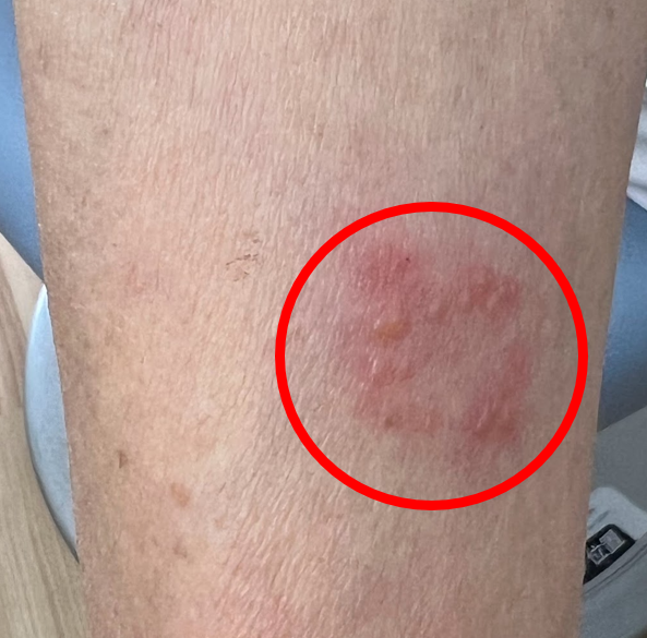 眼瞼ヘルペス よくある目の病気 13京橋クリニック眼科大阪市都島区京橋駅前の眼科専門のクリニック