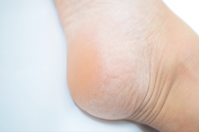 肌にたっぷり水分補給して、トラブル回避スキンケア講座持田ヘルスケア株式会社