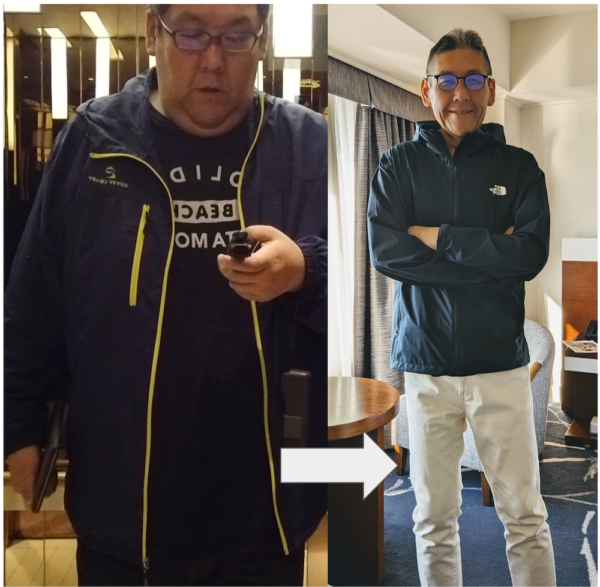 男性が顔痩せするには？顔痩せの方法やおすすめの美容施術も解説 - WOMクリニック銀座