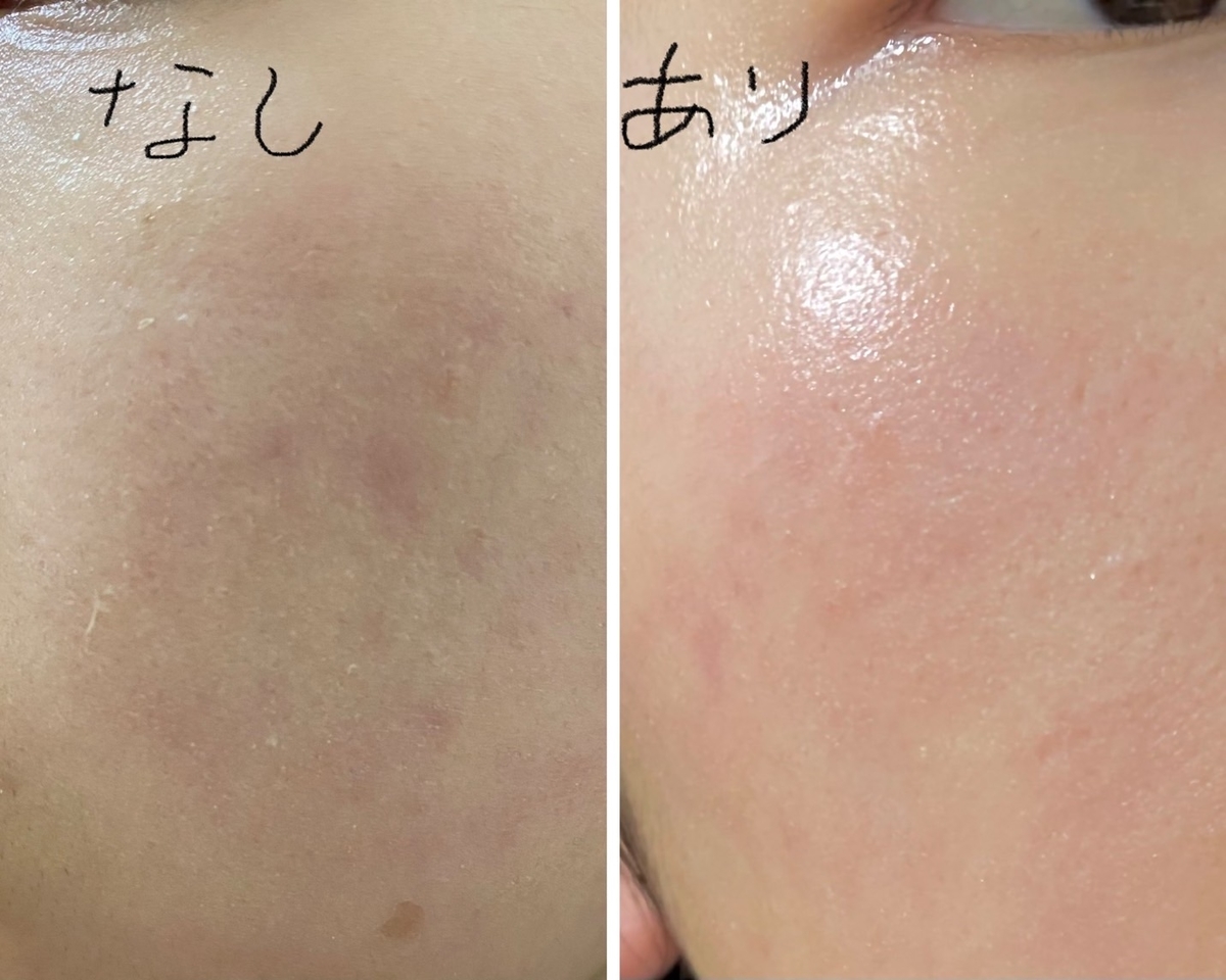 スキンケアはワセリンだけでいいってホント!? 乾燥肌の44歳がスキンケアをやめてみた