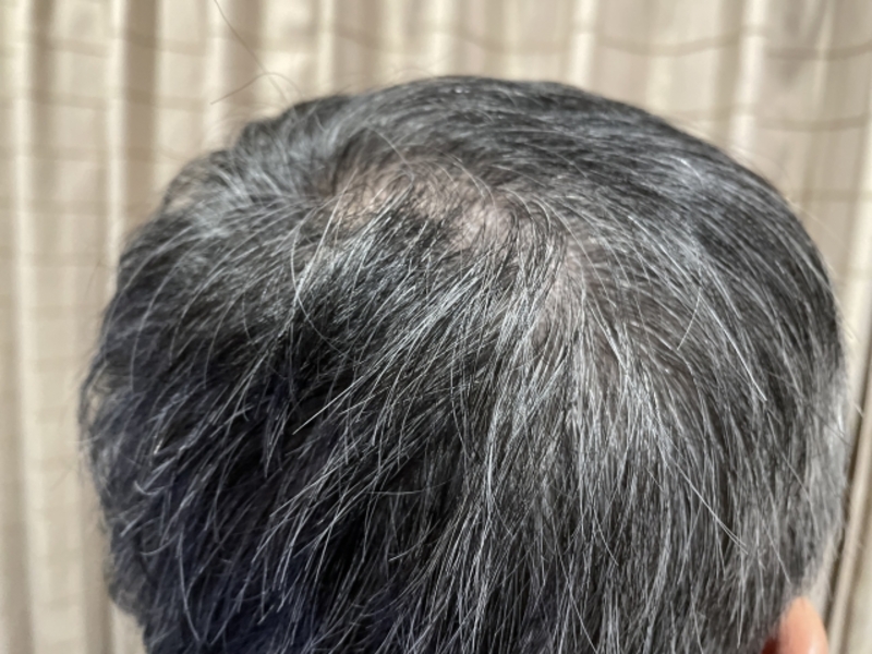 世界で最もセクシーなハゲ頭ランキング 6位ジョーダン、9位シャックは反応「受け入れてもいいけど 」バスケットボールキング