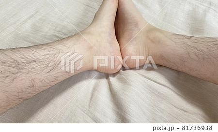 太股の毛の処理方法は？脱毛についても解説！メンズ脱毛百科事典 リンクスペディア