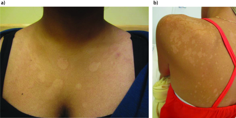 皮膚科の特色診療科・外来担当表日本赤十字社医療センター 渋谷区
