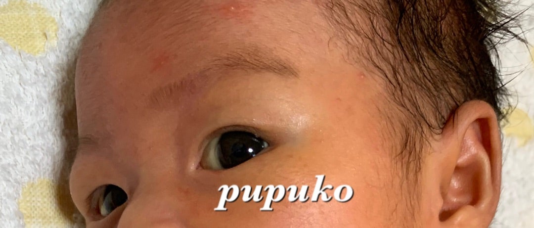 生後1ヶ月 赤ちゃん 黄疸の写真素材12286421- PIXTA