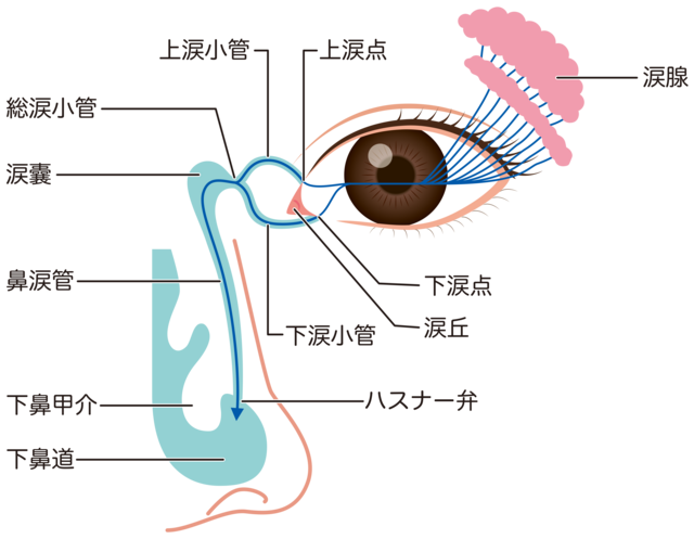 先天性鼻涙管閉塞開放術 ブジー処置金沢文庫アイクリニック