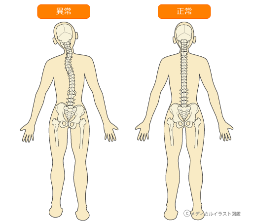 カツ丼のみ！胃下垂チャンネル再登場！TikTok