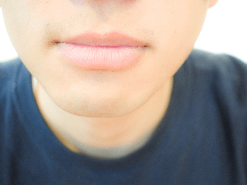 唇の色が悪いし紫になる原因と改善法は？NERO DOCTORBEAUTY 美容医療