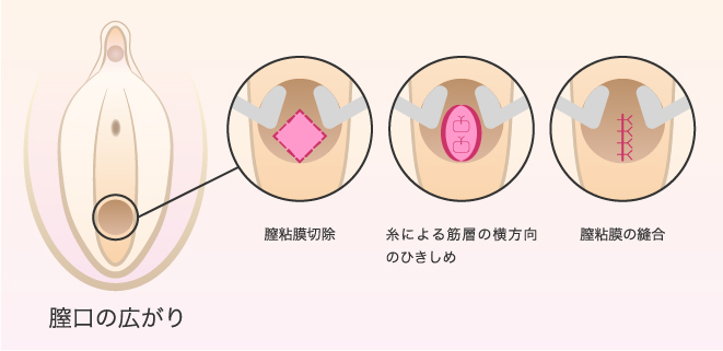 彼氏の愛情のこもった敏感マンコマッサージ、優しい手マン、体が震える、濡れたよだれ