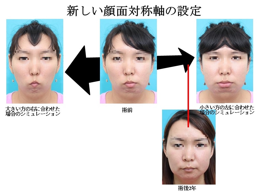 顔の歪みを直すなら口の中から！芸能人御用達“小顔矯正職人”のセルフケアを試した結果amazine