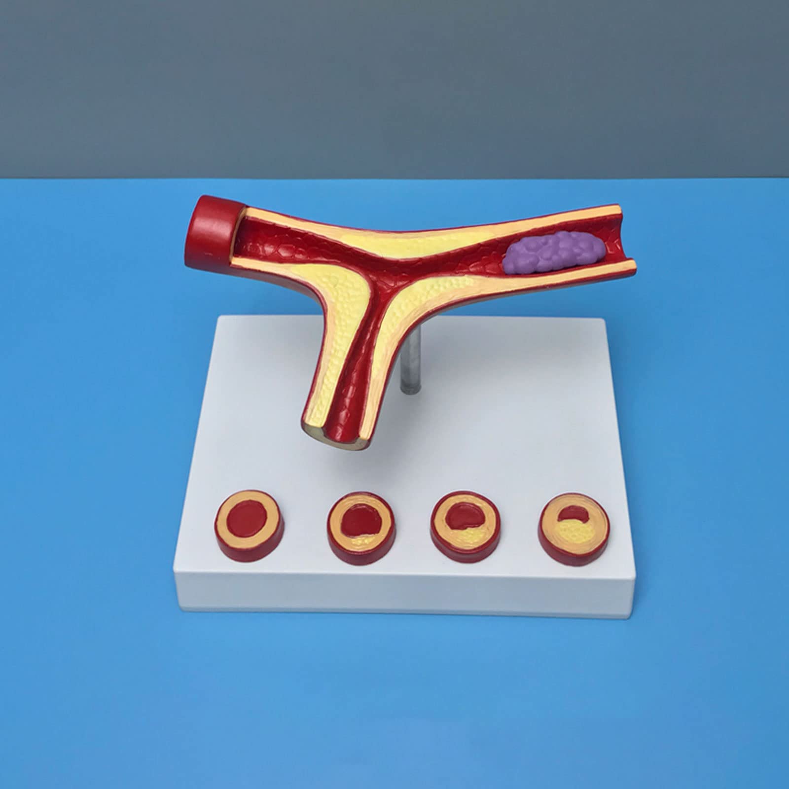 動脈硬化とはきむら内科小児科クリニック名古屋市緑区