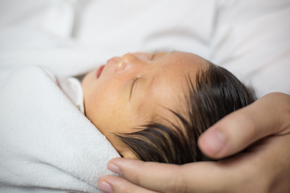 新生児の黄疸の原因と治療子供の病気All About