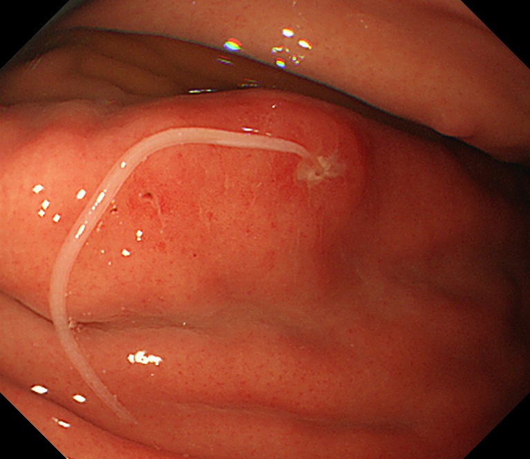 鞭虫」の写真・イラスト素材アマナイメージズ